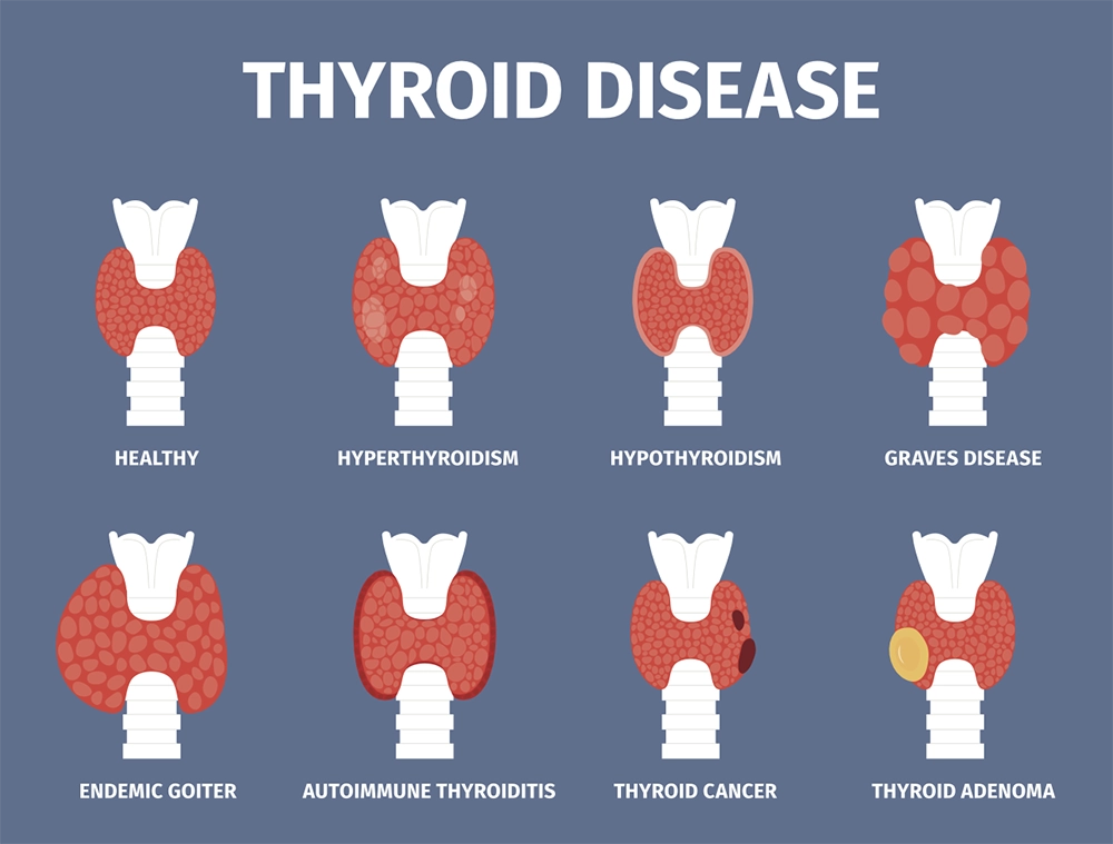 thyroid disease