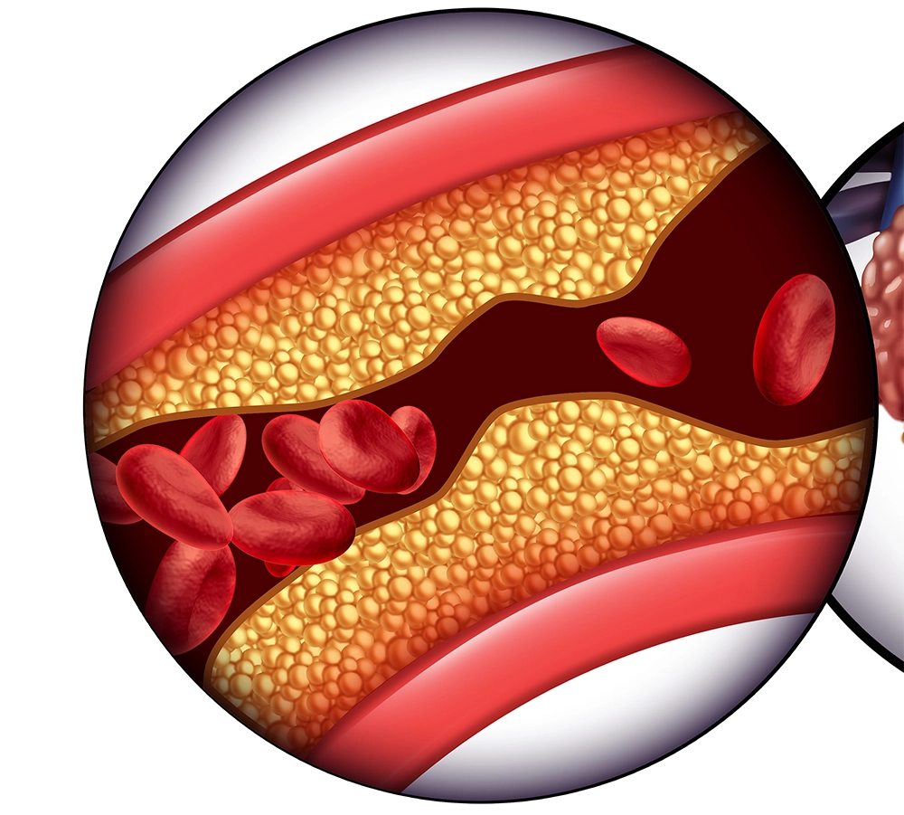 artery
