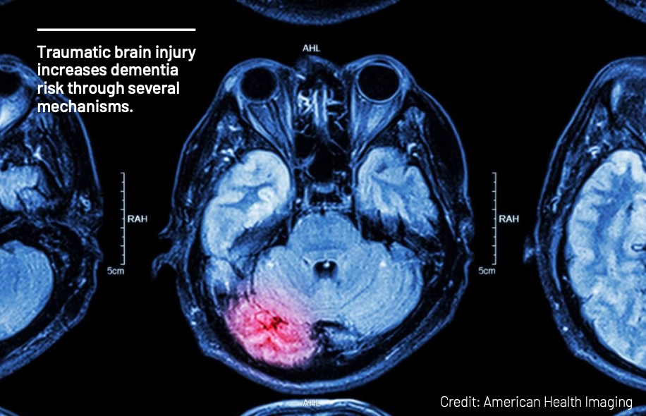 brain injury scan