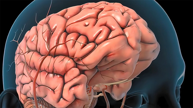 brain scan