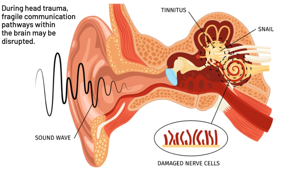 ear health