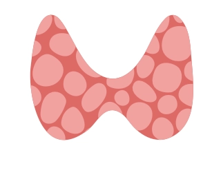rheumatoid arthritis