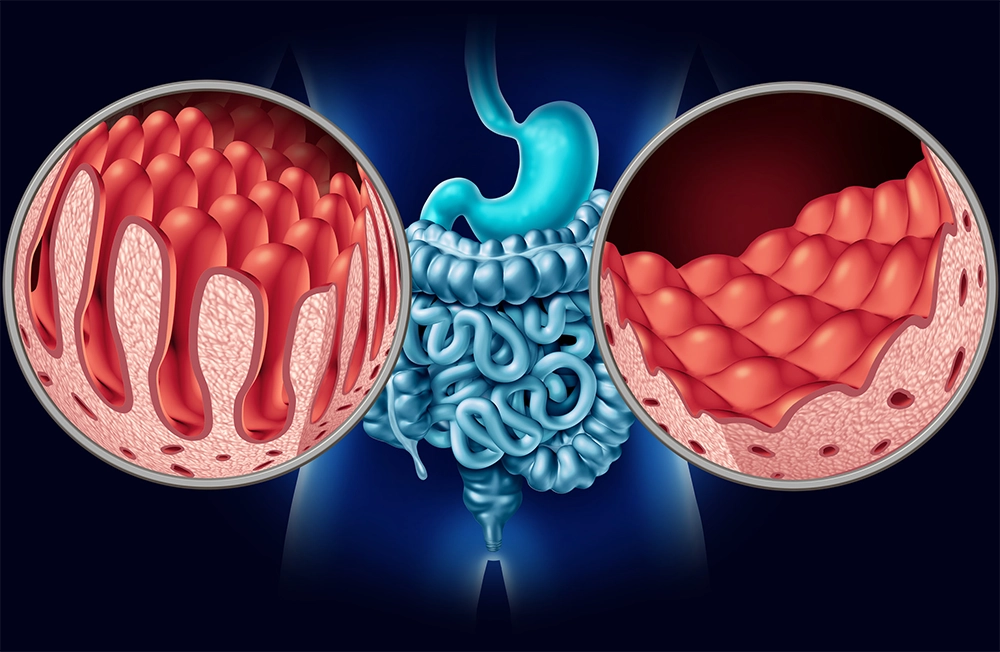 intestine health