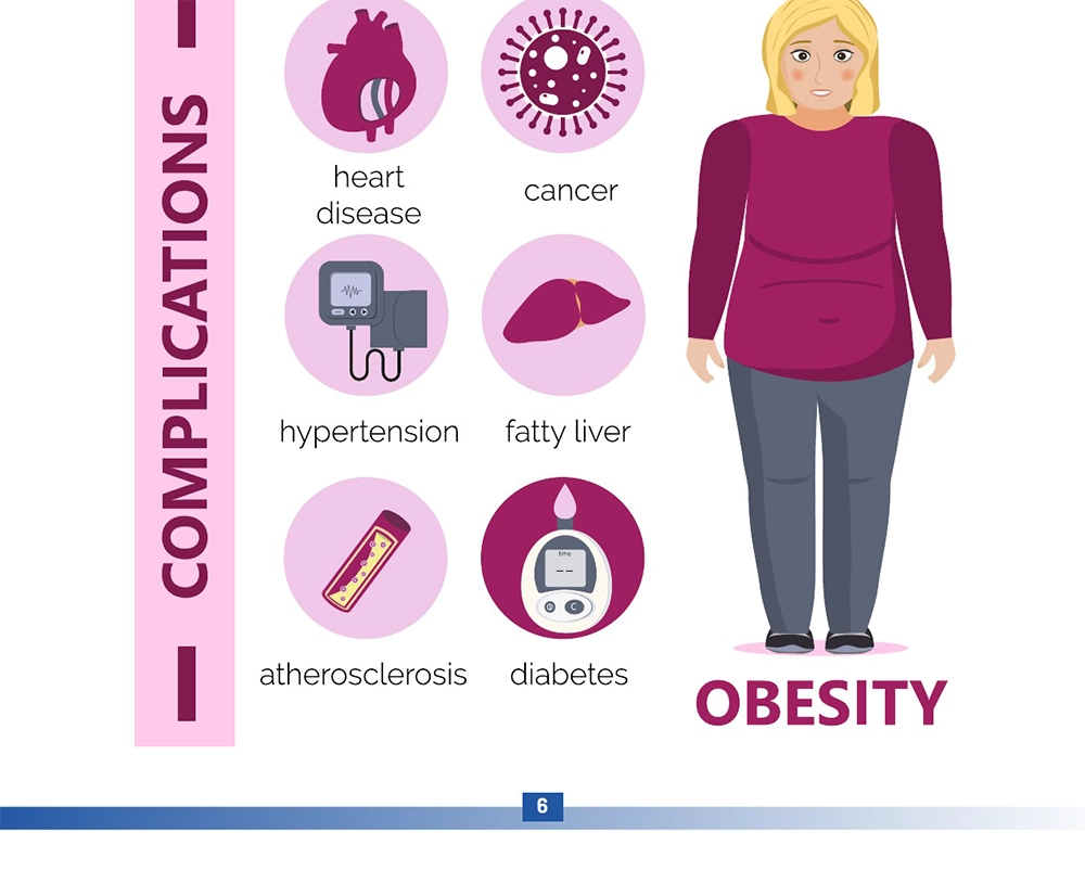 obesity infographic